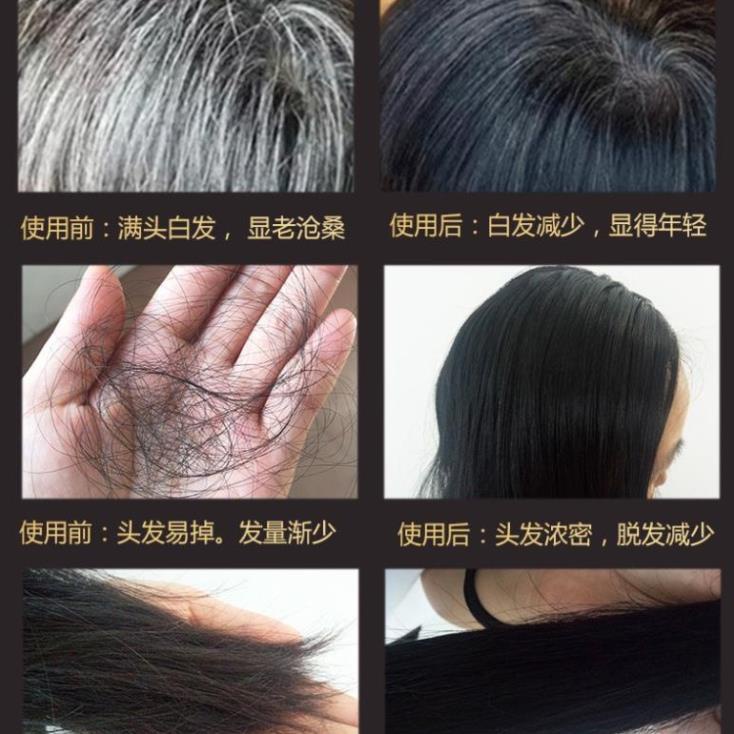 Dầu Gội Youlan Feisi Chứa Polygonum Multiflorum Giúp Nuôi Dưỡng Tóc