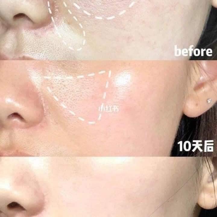 Serum Niacinamide 10% + Zin C 1% The Ordinary 30ml