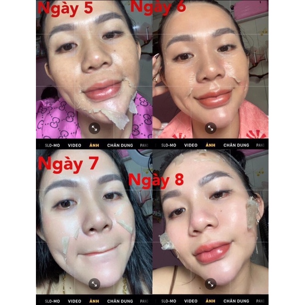 Combo Peel Da Tảo Sâm 36 Vị + Kem Face Phục Hồi Da HA MeeA Organic + Mặt nạ