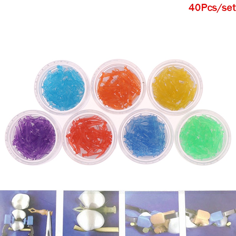 Hộp 40 Miếng Chêm Nha Khoa Bằng Nhựa Có Thể Tháo Rời