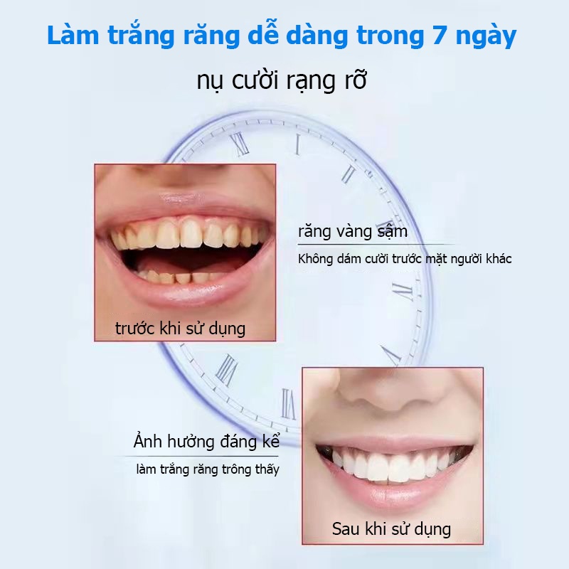 Kem đánh răng QIANKY SP-4 Liệu thô Thụy Sĩ sáng bóng trắng răng hơi thở thơm tho toothpaste Whitening 120g Ngừa Sâu Răng
