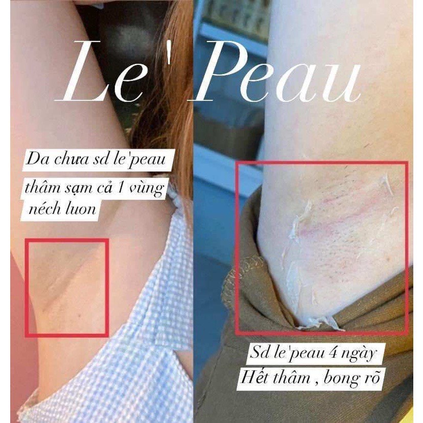 Peel nách retinol, peel da body trắng da mờ thâm sau 7 ngày SIÊU HOT nhà LEPEAU hiệu quả rõ rệt