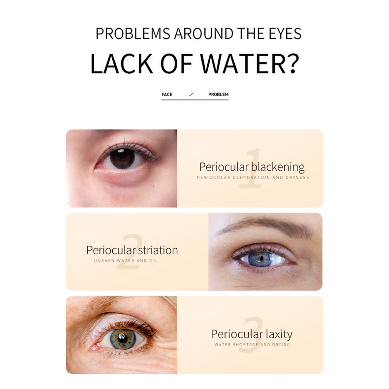 Kem mờ thâm mắt Bioaqua Kem dưỡng mắt sáng da cấp ẩm xóa nhăn tinh chất cám gạo Morasa BA16