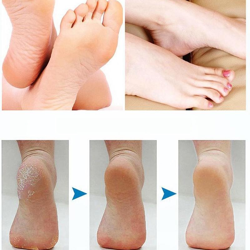 Máy Chà Gót Chân Máy Mài Gót Chân Tích Điện Cầm Tay Dễ Dàng Di Chuyển PAPAA.HOME