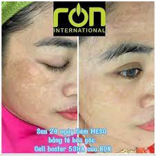 Tinh Chất Tế Bào Gốc Căng Bóng Da 53HA Doctor Premium Cell Booster - Ron