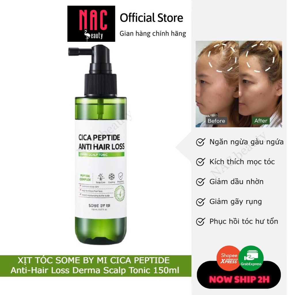 Xịt dưỡng ngăn ngừa rụng tóc Some By Mi Cica Peptide Anti-Hair Loss Derma Scalp TONIC 150ml