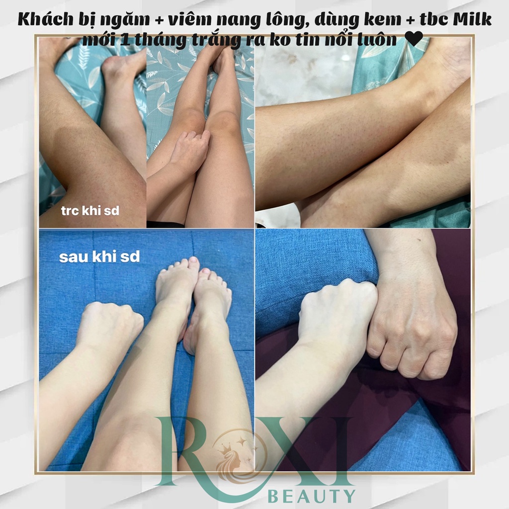 Kem dưỡng thể trắng da Body Milk ko bết rít, dưỡng trắng da body toàn thân giá sỉ