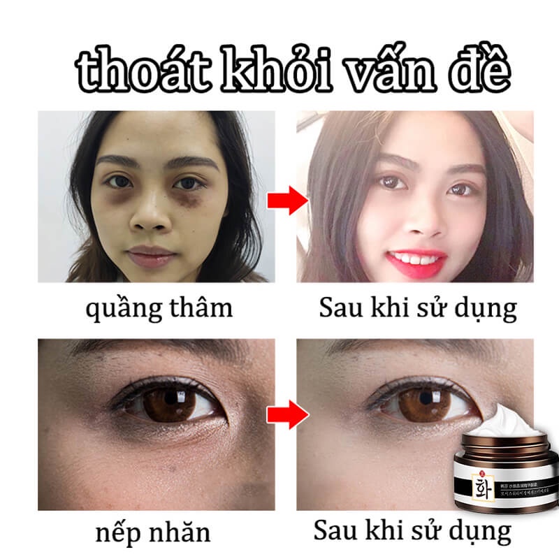 Kem Dưỡng Da Mắt 30g Chống Quầng Thâm Và Nếp Nhăn Làm Săn Chắc Da