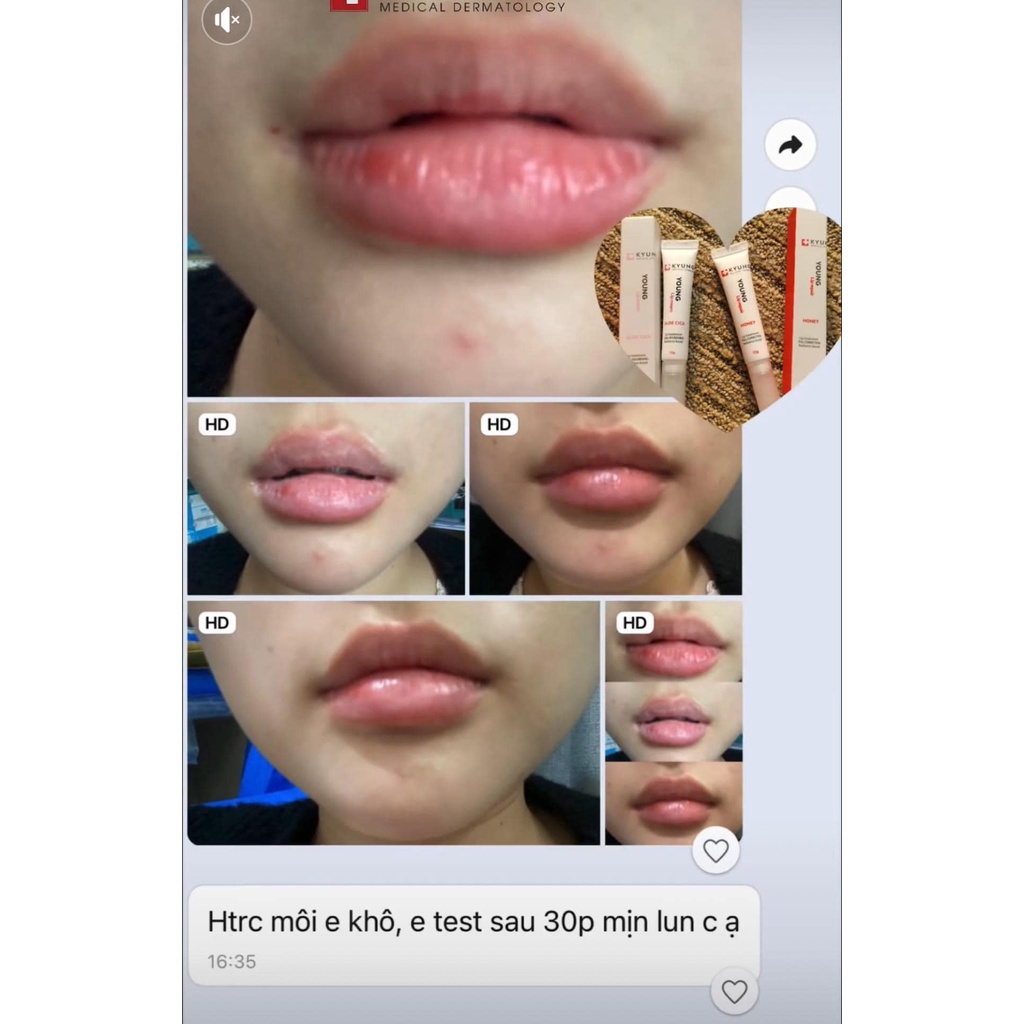 Bộ son dưỡng môi và kem dưỡng cấp ẩm làm dịu môi Young Lip Cream & Young Lip Repair, Son dưỡng môi Kyunglab