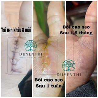 Dưỡng da 123 Bách Y Sâm
