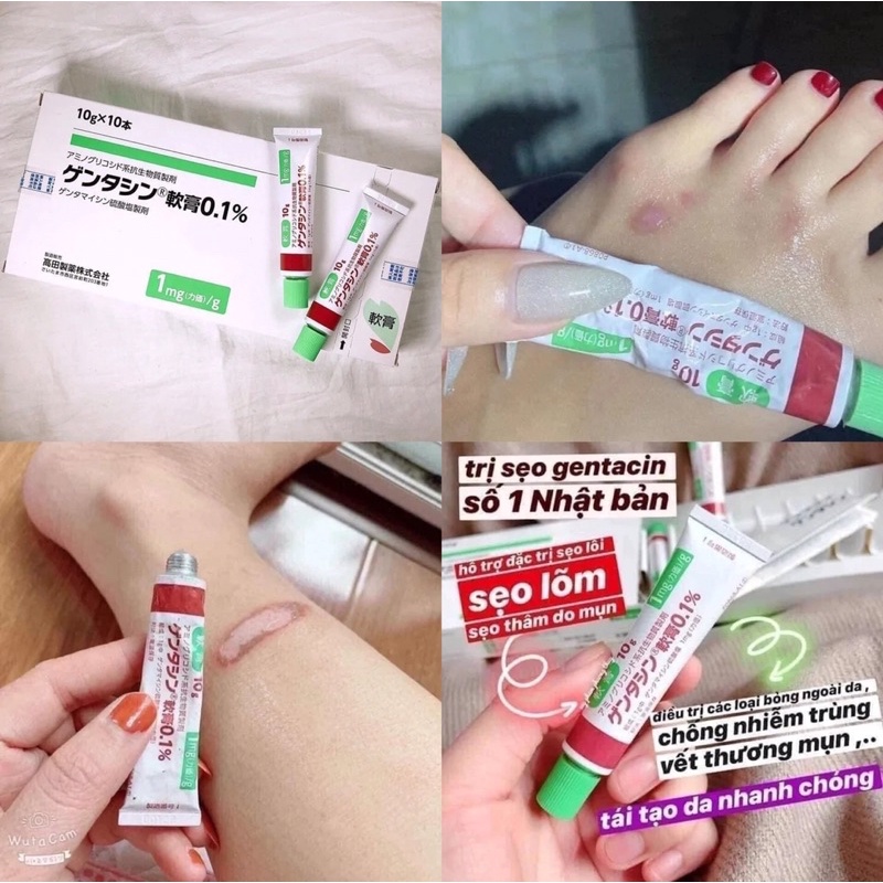 Gel Giảm Thâm, Mờ Sẹo Nhật 10g