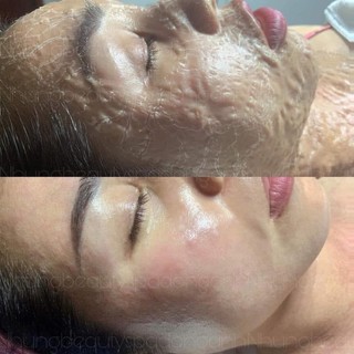 Bộ chăm sóc da Enzym therapy