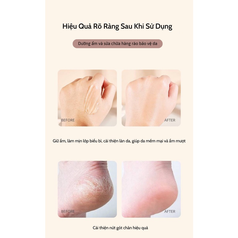 Kem Dưỡng Da HEYXI Giảm Nứt Gót Chân, Khô Da Chân, Dưỡng Dót Chân, Da Tay, Dưỡng Da Môi