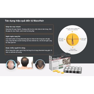 MAXXHAIR -Giúp mọc tóc - ngăn rụng tóc