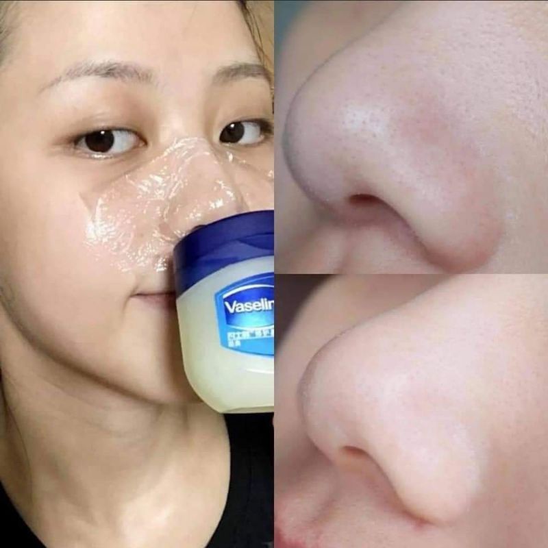 Sáp dưỡng đa năng Vaseline