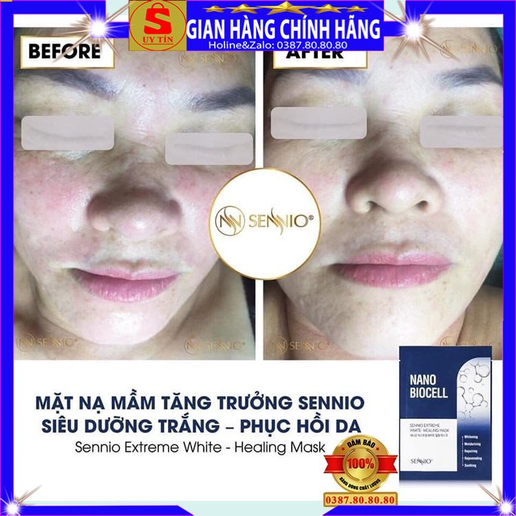 Sét 10 gói mặt nạ siêu trắng nano mầm tăng trưởng nhau thai giấy Sennio hàn quốc dưỡng cấp ẩm trắng da mặt giảm mụn nám