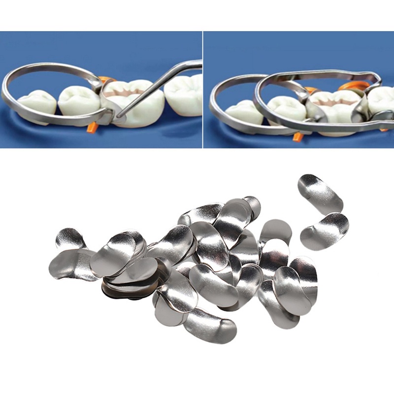 Set 100 Răng Kim Loại Số 1.398 Chuyên Dụng Cho Nha Khoa