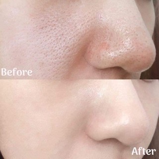 Peel da Red Peel Tingle Serum