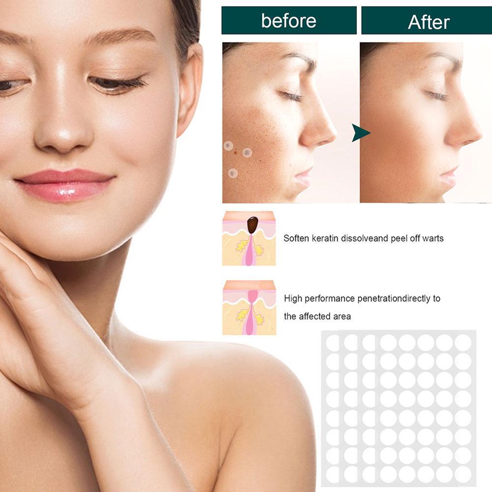 Bộ 120 Miếng Dán Đa Năng Loại Bỏ Mụn Trứng Cá Và Phân Tử Chăm Sóc Da Vô Hình