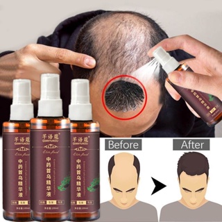 Tinh chất đen tóc Dầu dưỡng tóc ủ tóc phục hồi hư tổn serum dưỡng tóc dầu xả tóc Xịt tóc đen xịt mọc tóc 100ml