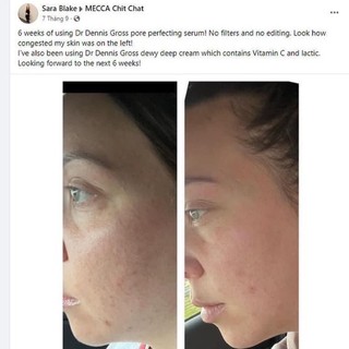 [Mini 7ml] 𝐒𝐞𝐫𝐮𝐦 𝐕𝐢𝐭𝐚𝐦𝐢𝐧 𝐂 𝐥𝐚𝐜𝐭𝐢𝐜 𝐨𝐢𝐥-𝐟𝐫𝐞𝐞 Dr dennis Gross