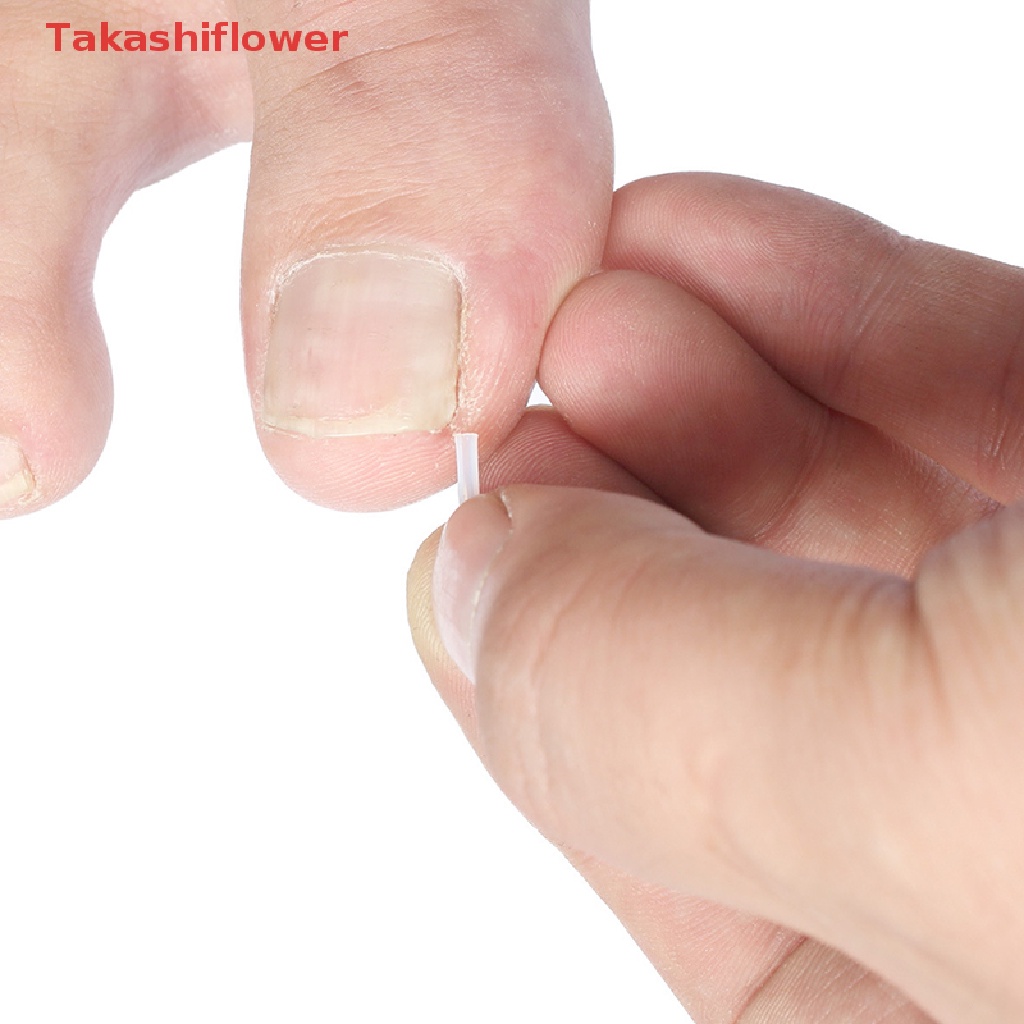Set 10 Miếng Đệm Chỉnh Hình Móng Chân Chuyên Dụng