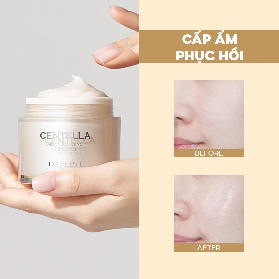 Kem Dưỡng Ẩm Làm Dịu Da Dr.Pepti Centella Moist Soothing Gel Cream 70ml | BigBuy360 - bigbuy360.vn