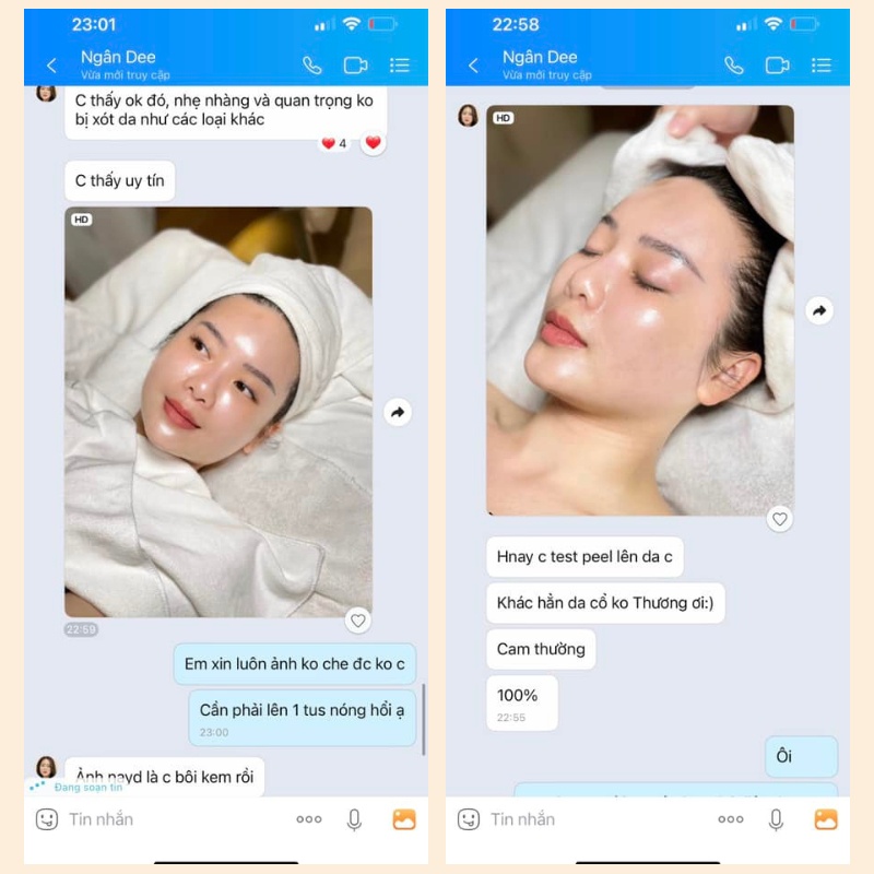 Peel da , P-Peel  + Neutralizer Kyunglab thay da sinh học, giúp tái tạo da trắng sáng , căng bóng ,mịn màng | BigBuy360 - bigbuy360.vn