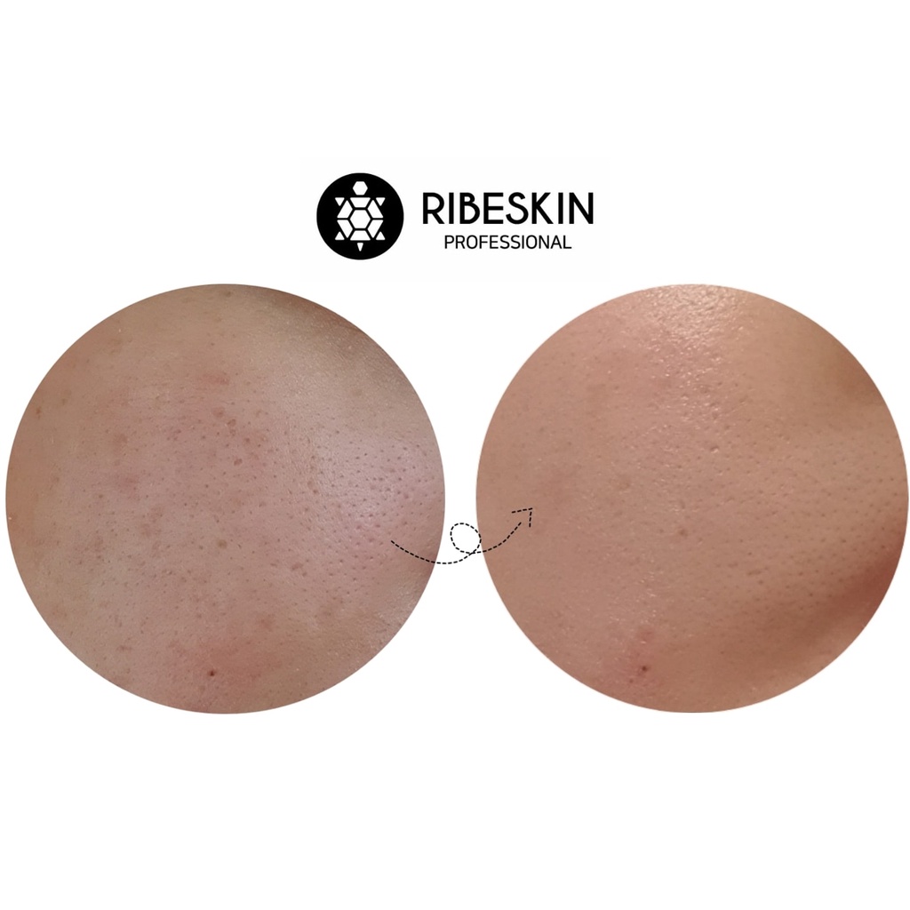 Mặt nạ phục hồi và dưỡng ẩm EP+ After Care Booster Mask 25 miếng