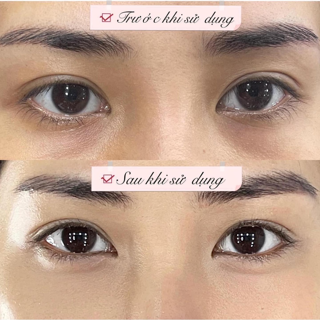 Kem mắt xoá nhăn, mờ thâm Rosa Monde Retinol 0,1%