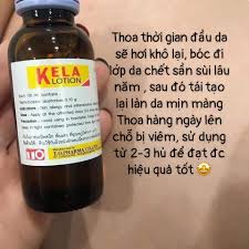 Kela Lotion Dùng Cho Da Viêm Lỗ Chân Lông Hàng Chính Hãng - dinh_huan_hungqn
