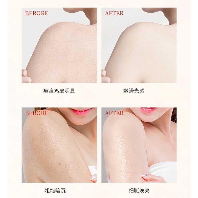 Tẩy da chết Cath Kidston hũ 240g + kem tay