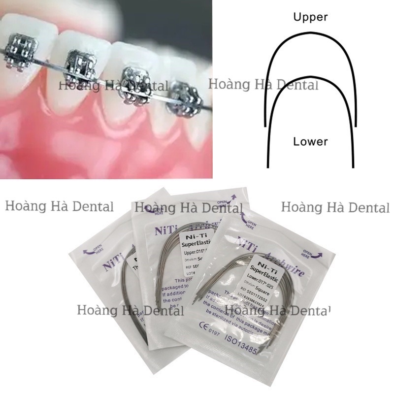Dây cung niti chỉnh nha dây cung niềng răng