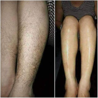 Wax Lông + Mỡ Trăn Triệt Lông An Lành ( Wax+Mỡ trăn 10ml+1Set Giấy và 2Que) ...