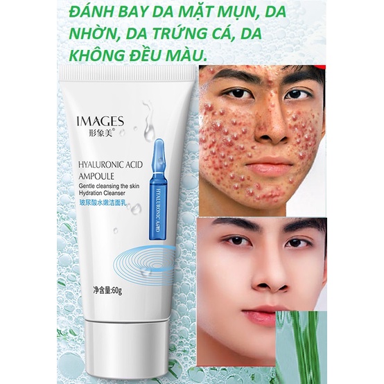 SỮA RỬA MẶT NAM GIỚI ĐÁNH BAY MỤN LÀM DA TRẮNG SÁNG KIỀM DẦU 60g
