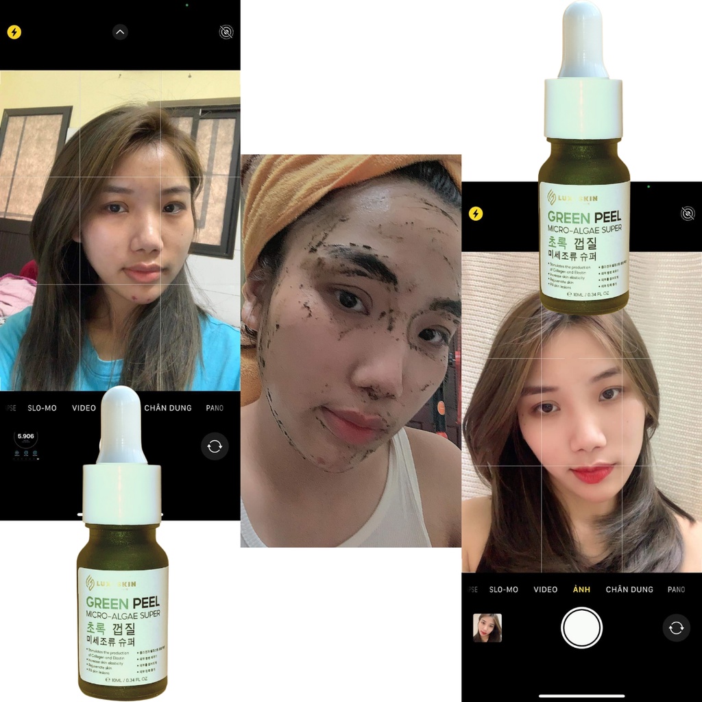 Peel Da Vi Tảo Tái Tạo Da Làm Mờ Vết Thâm Nếp Nhăn, Sẹo Lột Da Để TẩyTế Bào Chết. Thích Hợp Cho Mặt, Nách, Mông Và Lưng