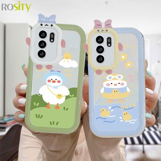 Ốp Điện Thoại Cho OPPO A96 A76 A16 A15 A57 A54 A5S A3S A95 A56 A55 A77S A7 A5 A9 A31 A53 A33 2020 A12 A1K A16E A16K A54S Reno 5 Lite 5F A74 A15S A52 A11K A92 A35 A11 A93 A32 A72 A94 A53S F19 F17 21 PRO A16S A77 A57S A57E