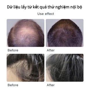 Tinh Chất Kích Thích Mọc Tóc Cải Thiện Tình Trạng Rụng Tóc 30ml