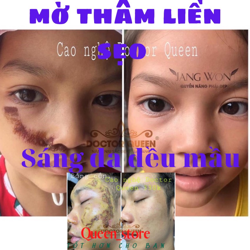 Cao nghệ Doctor queen mờ thâm liền sẹo góp phần mờ thâm nám chống lão hóa kem nghệ colegen doctor queen mẫu mới