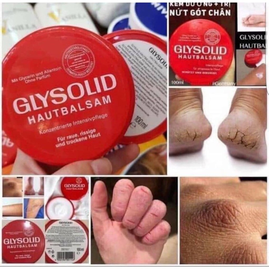 Kem dưỡng + Đánh bay nứt nẻ tay chân, á sừng với Glysolid 100ml- Hàng Chuẩn Đức
