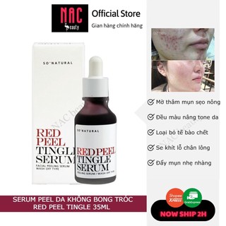 Serum Peel da không bong tróc Red Peel Tingle 35ml - NAC BEAUTY so natural