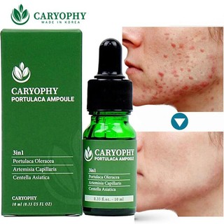 Serum giảm mụn mờ thâm Caryophy 10ml