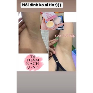 (beovi)KEM DƯỠNG TRẮNG GIẢM THÂM NÁCH QNIC CARE THÁI