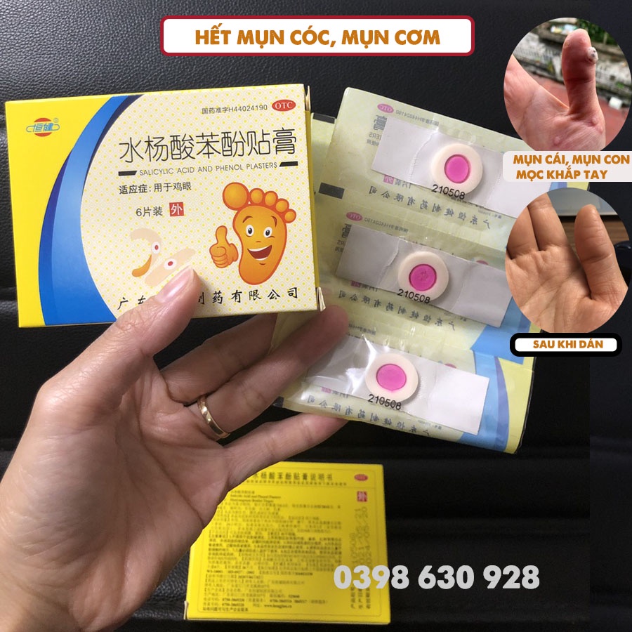 Miếng dán mụn cóc, mụn cơm hộp 6 miếng