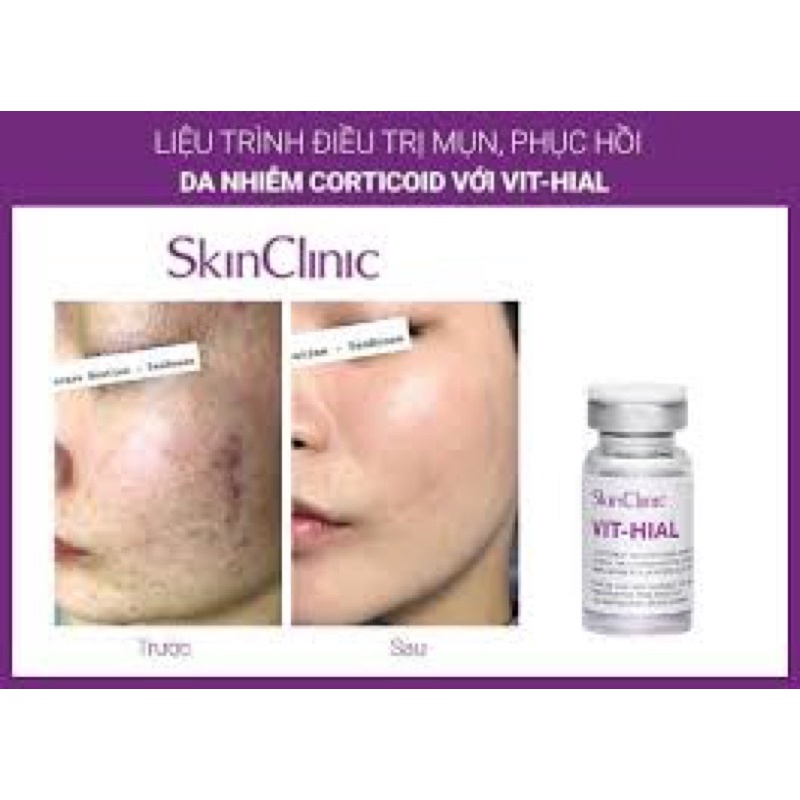 VIT-HIAL-sản phẩm chống lão hóa, phục hồi và tái tạo da bán lẻ 1 lọ