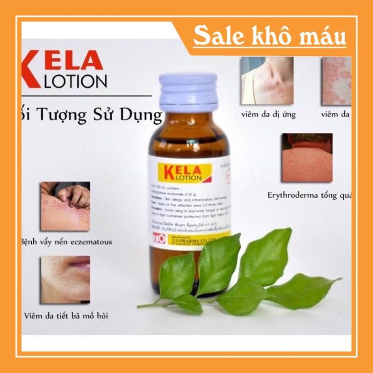 Kela Lotion Dùng Cho Da Viêm Lỗ Chân Lông Hàng Chính Hãng - dinh_huan_hungqn