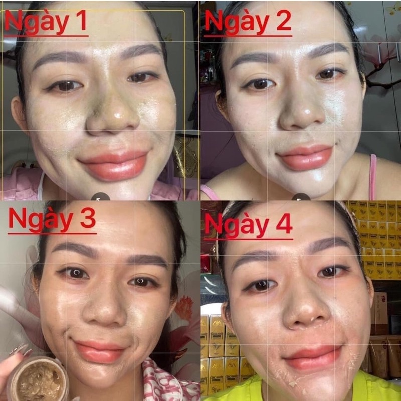 Combo Peel Da Tảo Sâm 36 Vị + Kem Face Phục Hồi Da HA MeeA Organic + Mặt nạ