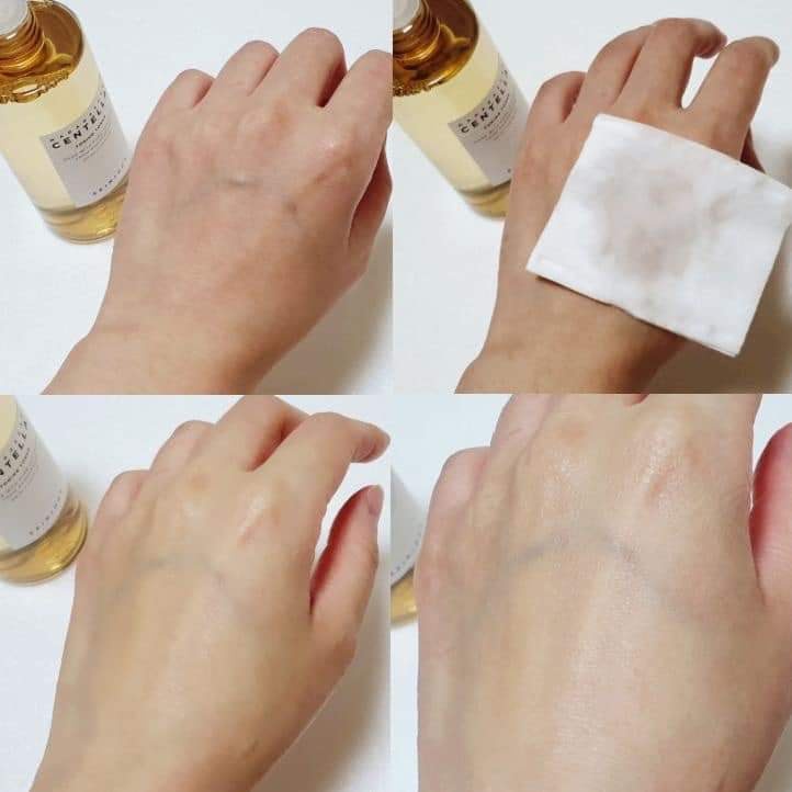 Tinh Chất Rau Má giảm Mụn, Phục Hồi Da Skin1004 Madagascar Centella Asiatica 100 Ampoule 100ml Serum - PRO01