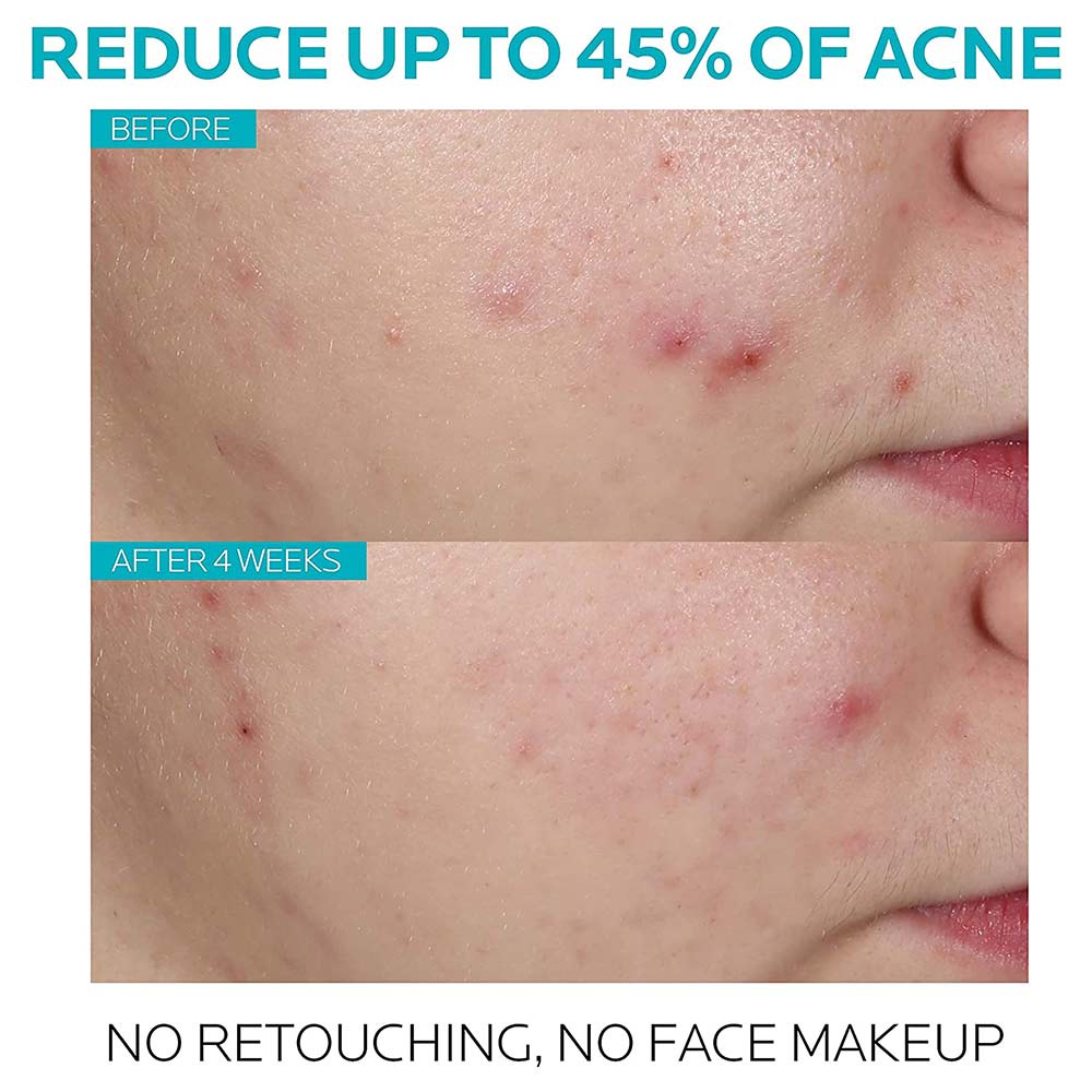 La Roche-Posay Effaclar Serum Anti-Acne Concentrate – Anti-Acne/jerawat