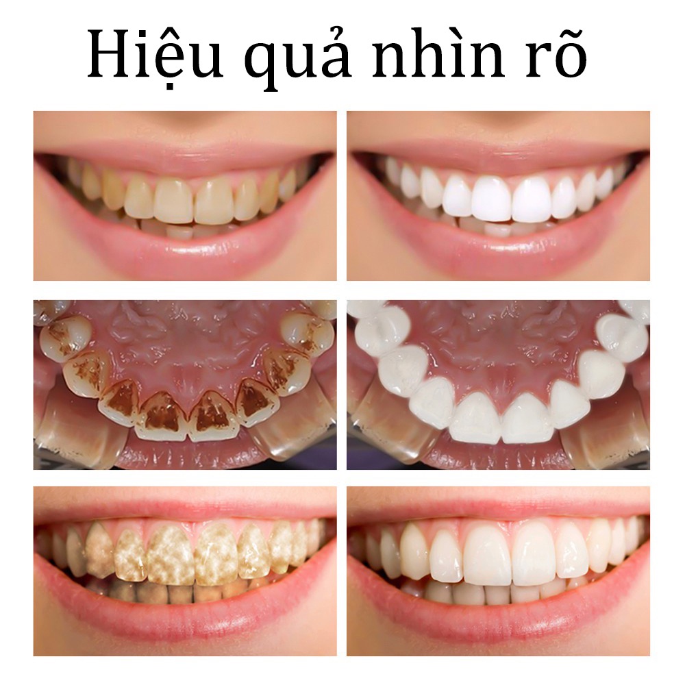 Kem Đánh Răng Làm trắng răng kem đánh răng 180g loại bỏ mảng bám trên răng nhanh chóng ố cao răng ngăn ngừa hôi miệng